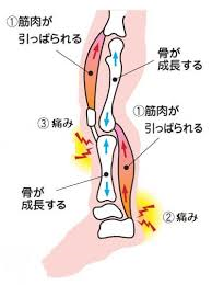 成長痛4